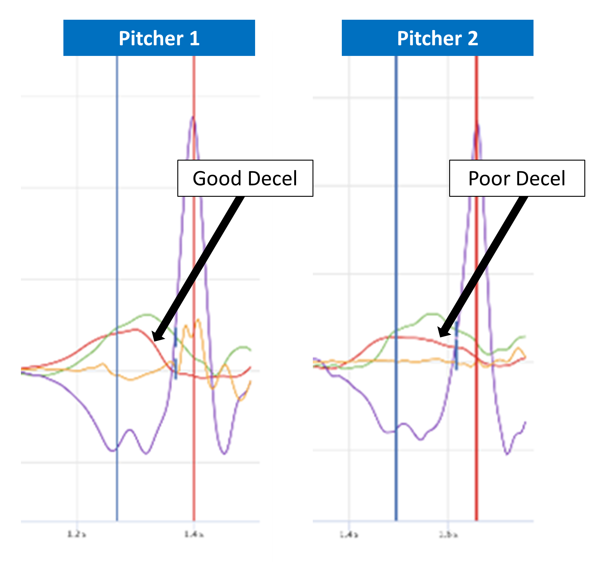 How to Create a Better Lead Leg Block • RPP Baseball