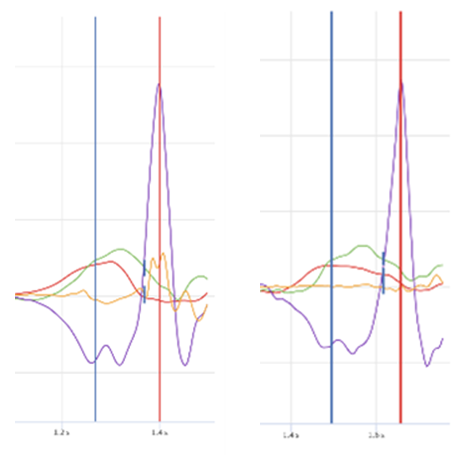 How to Create a Better Lead Leg Block • RPP Baseball
